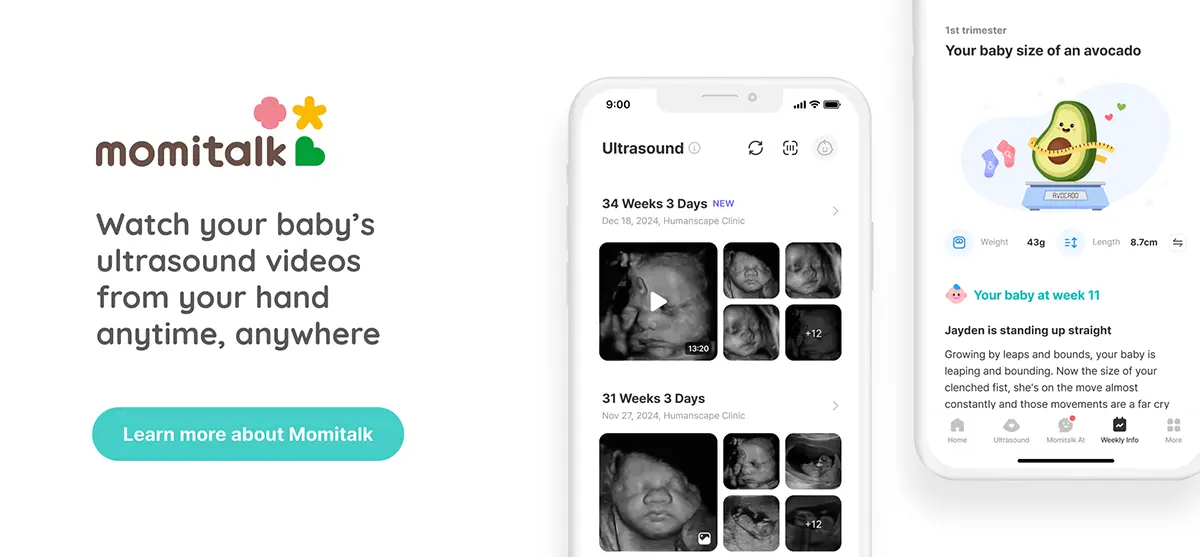 Momitalk Baby Ultrasound Video Pictures Software.