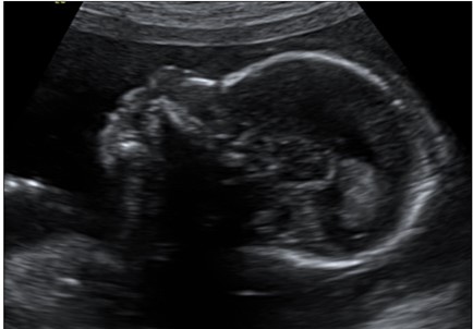 Obstetric Ultrasound Durango Colorado